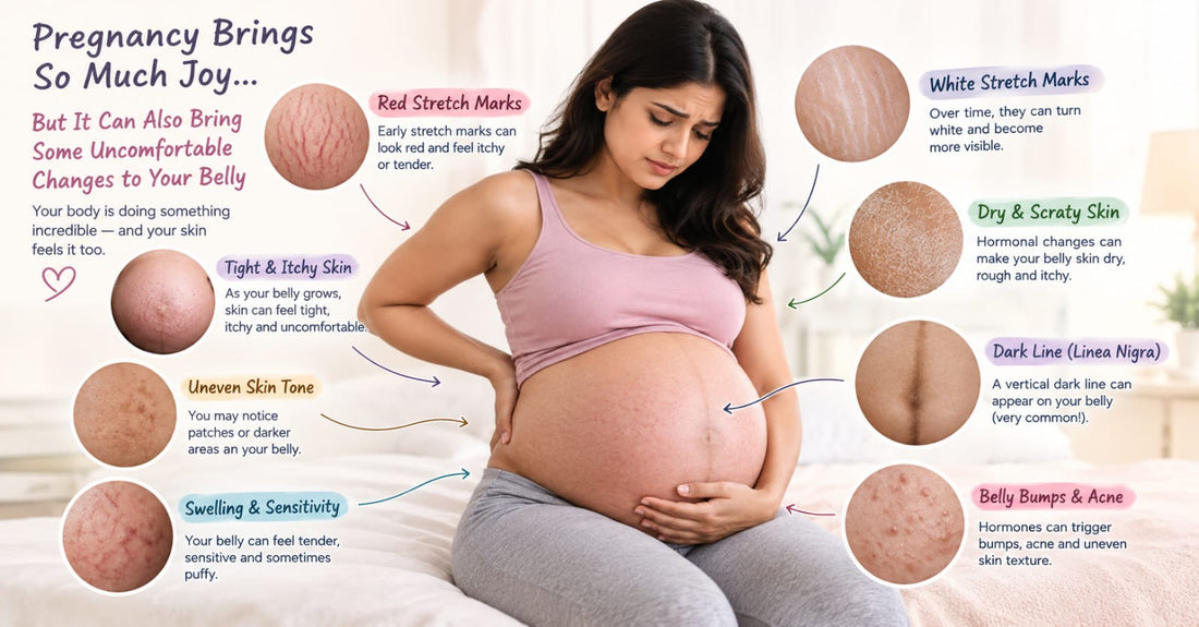 Pregnancy Stretch Marks: When They Appear, Why They Happen, and What Actually Fades Them