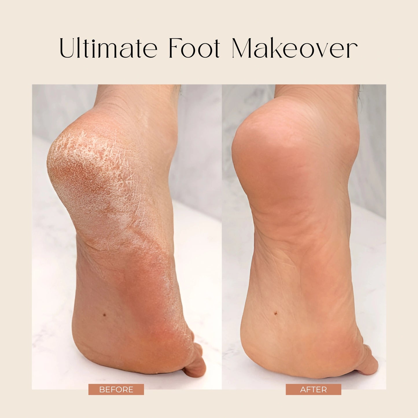 Peel and Heel Exfoliating Foot Peel Mask with AHA BHA & Shea Butter