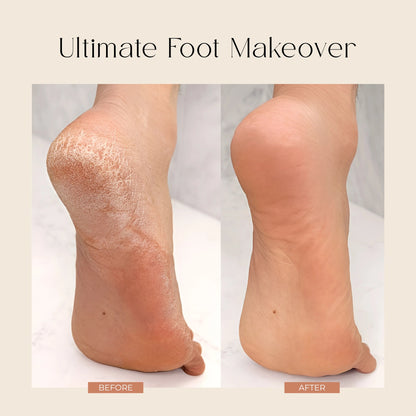 Peel and Heel Exfoliating Foot Peel Mask with AHA BHA & Shea Butter