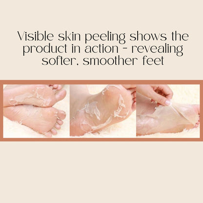 Peel and Heel Exfoliating Foot Peel Mask with AHA BHA & Shea Butter