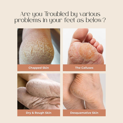 Peel and Heel Exfoliating Foot Peel Mask with AHA BHA & Shea Butter